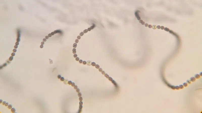 Blågrønalger set gennem mikroskop.